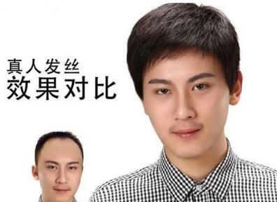出售假发:隐藏在身边的暴利网赚项目 2 image 20250305183928 983455